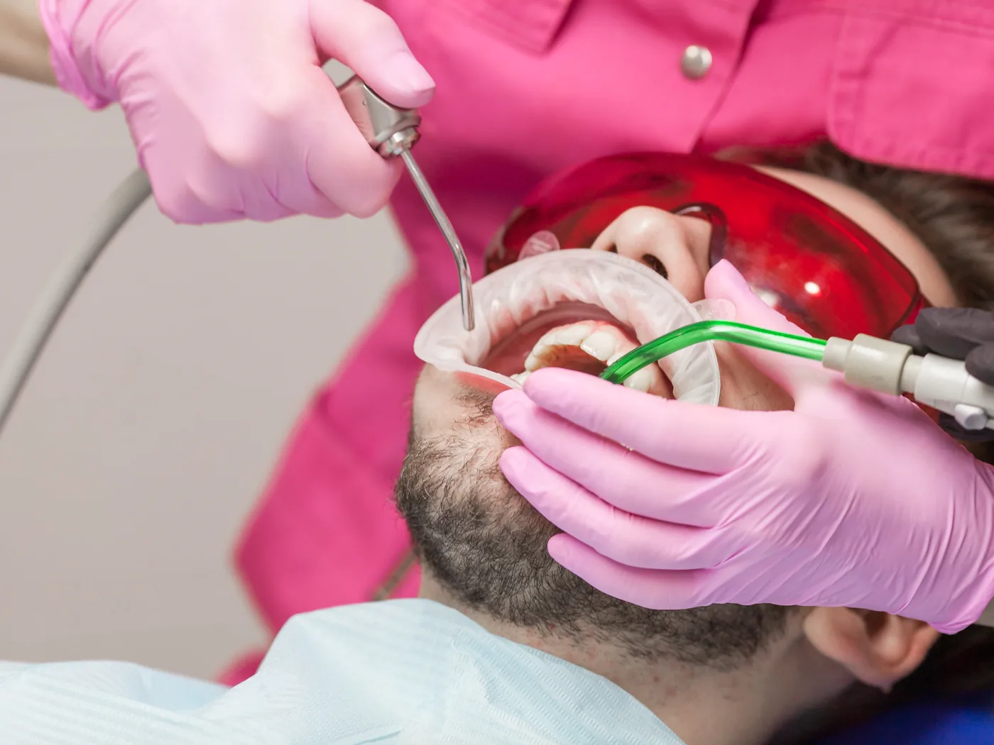 Igiene dentale professionale: cos'è, quando farla e perché conta