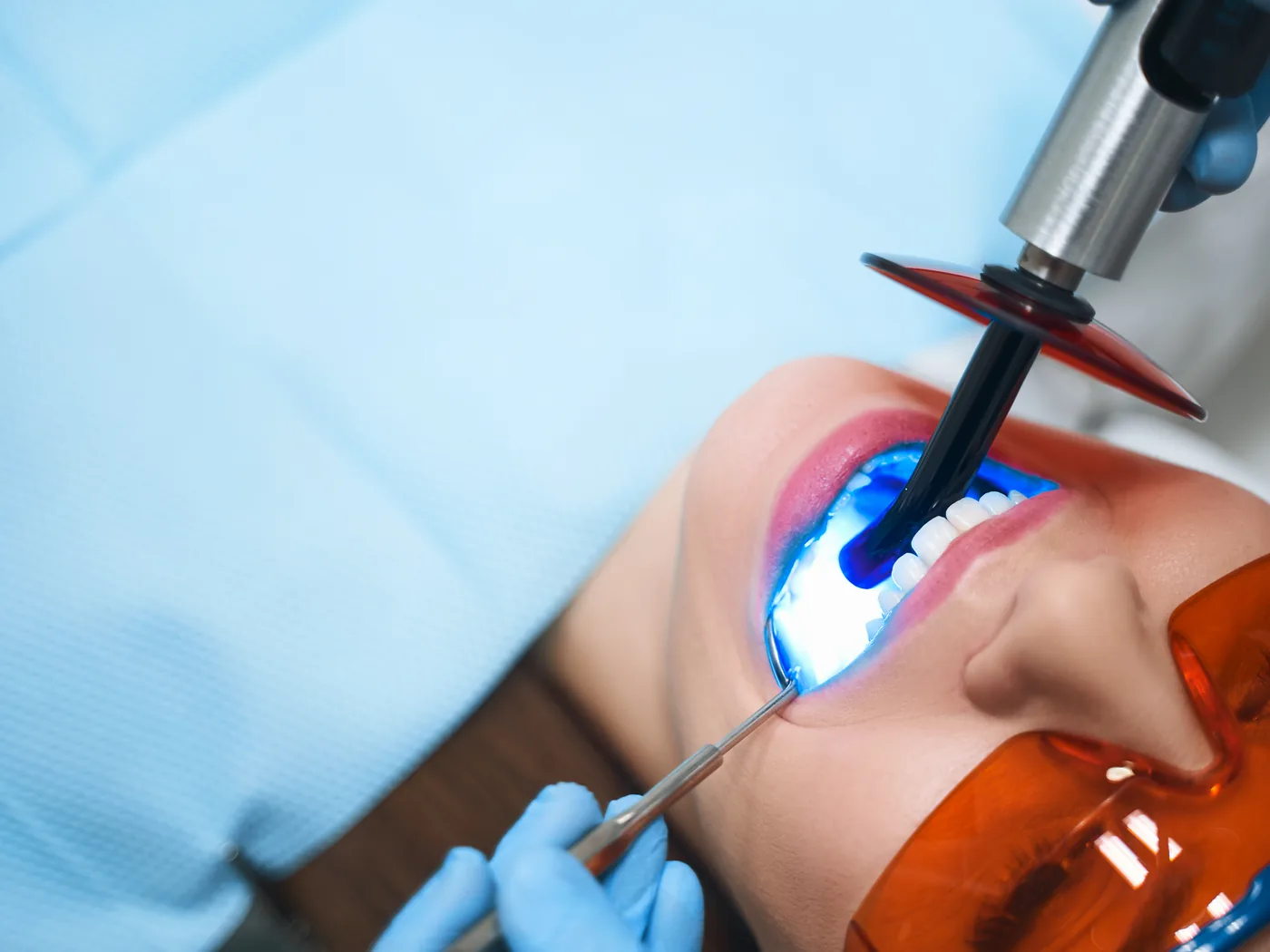 Sbiancamento dentale professionale: come funziona e cosa aspettarsi